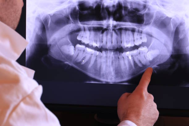 Best Same-Day Emergency Dentist in Swansboro, NC
