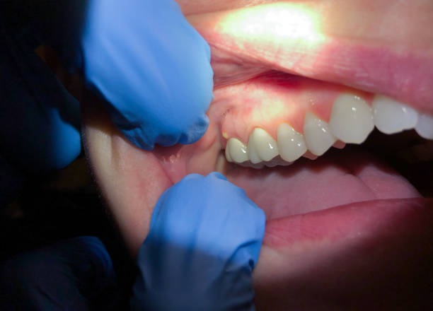 Best Pediatric Emergency Dentist in Swansboro, NC
